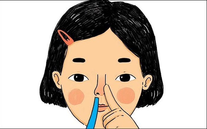 Dị vật trong mũi - Hình ảnh minh họa